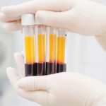 ứng dụng huyết tương giàu tiểu cầu trong IVF